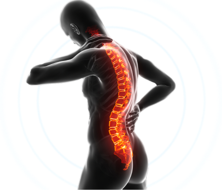 Ilustração da coluna vertebral com pontos de dor